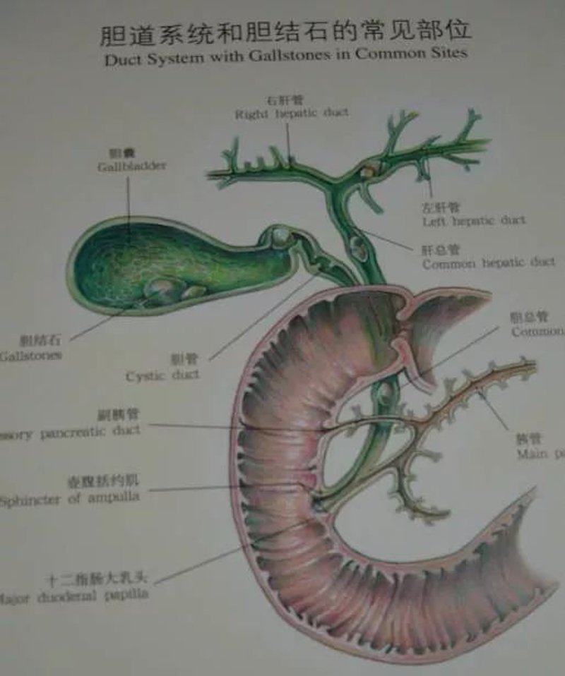 胆结石手术费用解析:一次性解决一切疑问
