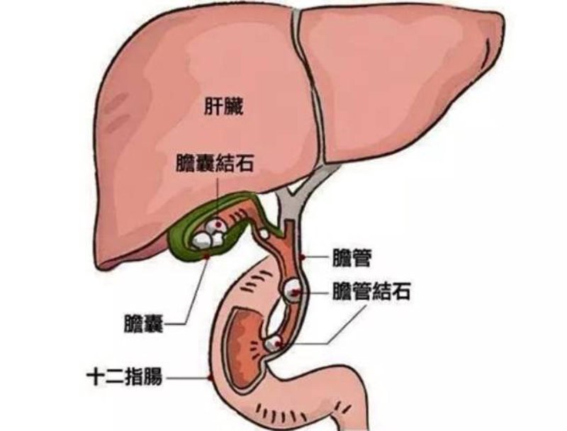 保肾取石的费用解析:怎样科学合理地进行经济规划?