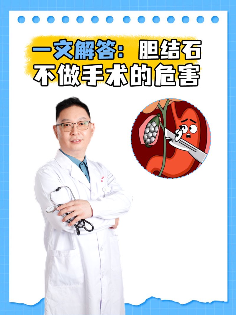 保胆取石