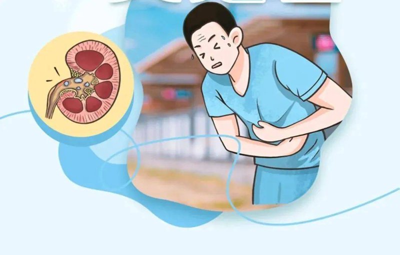 重庆结石病医院的治疗趋势:从传统到现代