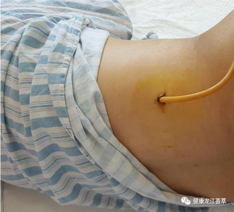 重庆结石病医院:选择最放心的就医之地